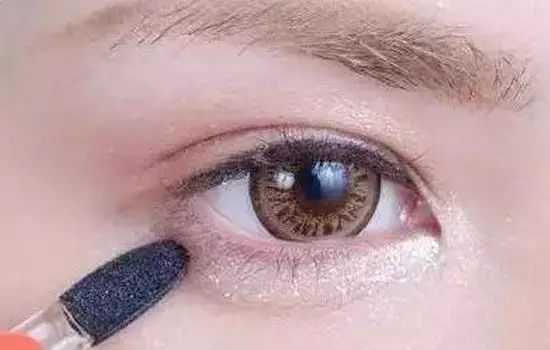 北京八大處了解王佳琦的雙眼皮割法