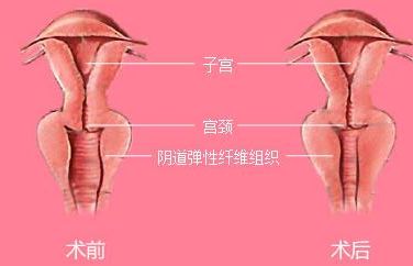 長(zhǎng)沙靠譜矯正醫(yī)院哪家好？解答你所有的疑慮！