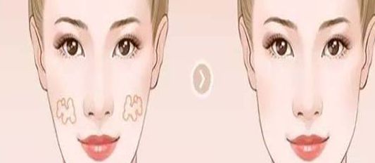 南京哪家醫(yī)院的小陰唇整形效果好？