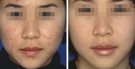 連云港眼部激光飛秒那家好？排名領先的專業(yè)眼科醫(yī)院推薦