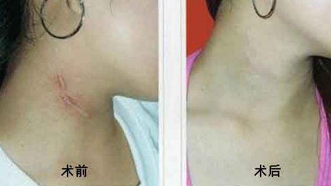 上海中西醫(yī)結(jié)合醫(yī)院整形美容科靠譜嗎？聽說口碑不錯(cuò)！