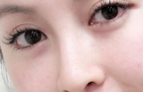 在烏魯木齊有哪些值得推薦的開眼角好醫(yī)院？