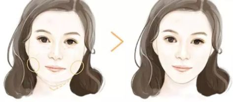 上海哪家下頜骨醫(yī)院好？解析上海下頜骨疾病常見(jiàn)病例及專業(yè)治療！