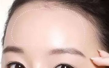 蘇州哪家黃褐斑醫(yī)院好？專業(yè)醫(yī)生推薦，讓你告別黃褐斑困擾！