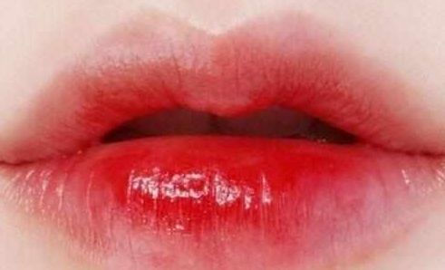 南寧祛疤整形哪家醫(yī)院最專業(yè)最受好評？