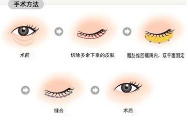 南寧治療痘印哪家醫(yī)院靠譜？—用戶首選南寧去痘印醫(yī)院排行榜