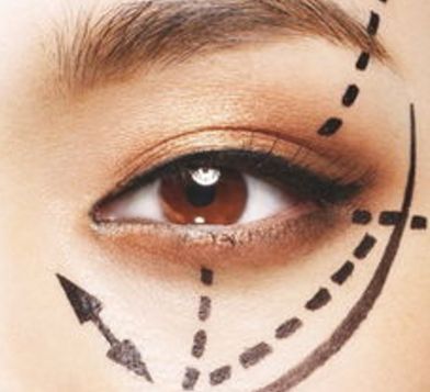 蘭州眼睛美容醫(yī)院哪家好？揭秘蘭州市最受歡迎的眼睛美容醫(yī)院排行榜！