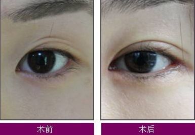 煙臺整疤痕哪家醫(yī)院好？了解煙臺整疤痕醫(yī)院的綜合評價和治療效果