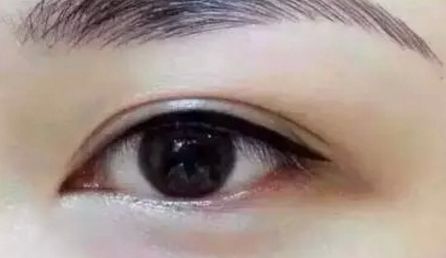 沈陽(yáng)友誼美容醫(yī)院劉金超的技術(shù)和口碑好嗎？地址詳細(xì)信息大揭秘！