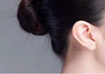 鄭州趙麗做雙眼皮修復(fù)效果如何？整形醫(yī)生背景和坐診情況請看！