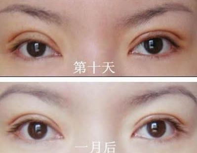 長春哪家醫(yī)院治痘痘好？了解長春市治療青春痘的?？漆t(yī)院及價(jià)格