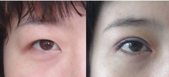 北京豐胸整形醫(yī)院哪家好？綜合評價(jià)和患者口碑推薦