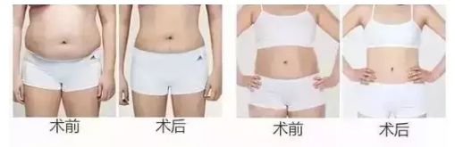 信陽去整形哪家醫(yī)院好？名副其實信陽市最佳整形醫(yī)院TOP推薦