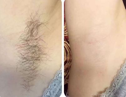 上海整形醫(yī)院哪家的好？最權(quán)威的排名榜單來幫你挑選！