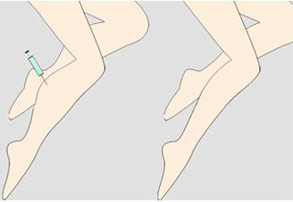 上海李昕醫(yī)生隆鼻技術(shù)實(shí)力有多強(qiáng)？揭秘國(guó)內(nèi)必備的一位鼻部整形專家
