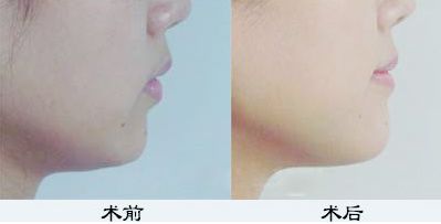 鄭州鼻綜合哪家醫(yī)院好？TOP醫(yī)療機(jī)構(gòu)大揭秘