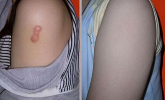 上海雙眼皮切開手術(shù)，哪家醫(yī)院技術(shù)好且安全？
