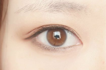 深圳北大醫(yī)院自體脂肪填充的效果如何？何君君醫(yī)生的資料和擅長特點(diǎn)分享！