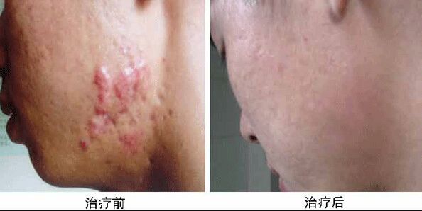 南京哪家醫(yī)院做兔唇手術(shù)效果好又安全？