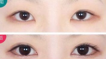 西安治療瘢痕哪家醫(yī)院好評不斷！