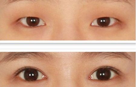 北京整容科好的醫(yī)院有哪些？中關(guān)村整形醫(yī)院綜合實(shí)力領(lǐng)先！