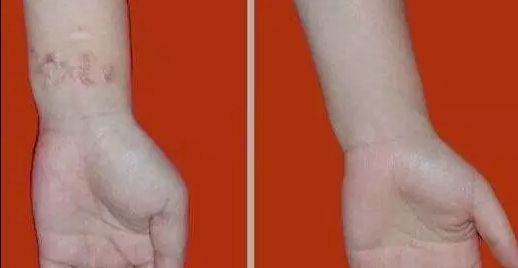 杭州哪家醫(yī)院看喉嚨好？排名最好的專業(yè)醫(yī)院推薦