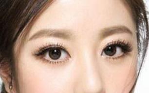 2023益陽(yáng)SMAS面部提升術(shù)正規(guī)專家排行10強(qiáng)(蔣友寧、吳自強(qiáng)、邱敏這幾個(gè)專家真不錯(cuò)！)