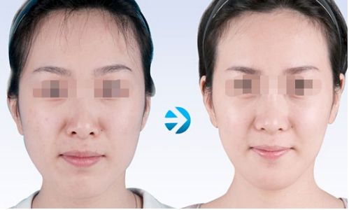 云南雙眼皮手術有哪些優(yōu)質醫(yī)院值得推薦？