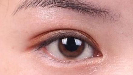 蘇州雙眼皮修復(fù)醫(yī)院排名及口碑，哪家醫(yī)院修復(fù)效果最好？