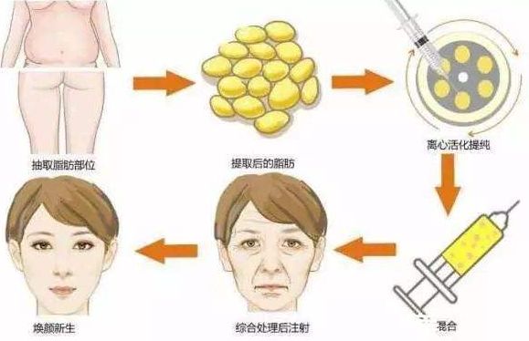 重慶整形磨骨哪家醫(yī)院好？整形醫(yī)院排行榜解讀，選擇最適合您的醫(yī)院！