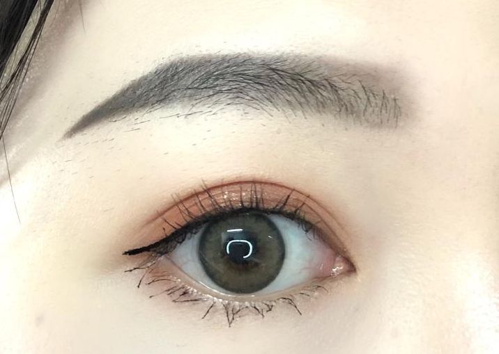 承德哪家整形醫(yī)院做雙眼皮效果好，選擇哪家醫(yī)院做雙眼皮效果最好