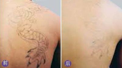 無錫哪家醫(yī)院眼科專業(yè)好？