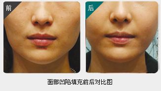 錦州整形美容醫(yī)院哪家靠譜？醫(yī)療技術(shù)如何？