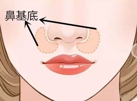 北京大學(xué)深圳醫(yī)院雙眼皮手術(shù)，何君君醫(yī)生口碑如何？資料公開！