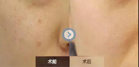 2023沈陽美膚祛斑專家上榜名單前10(敖彩虹、黎寶川、王志濤實力與口碑滿分！)