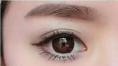 長沙哪位醫(yī)生擅長解燦割雙眼皮技術(shù)？