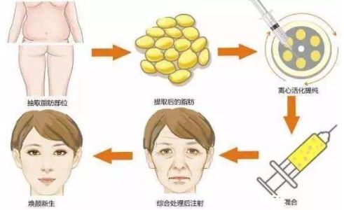 鄭州鼻整形哪家醫(yī)院好？一篇權(quán)威評測解答你的疑惑！