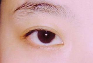 西安看胎記醫(yī)院哪家好？選擇胎記?？漆t(yī)院，專業(yè)技術(shù)得到用戶好評(píng)！