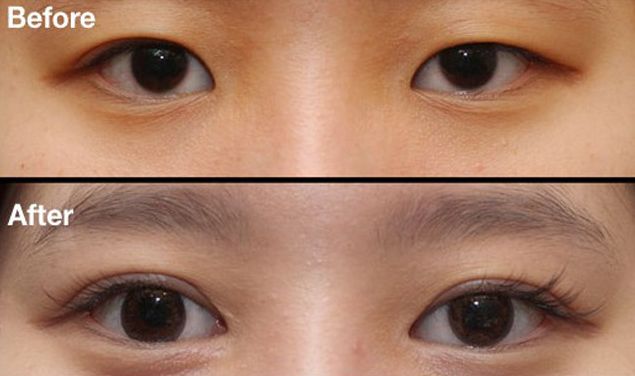 昆明刀疤修復(fù)哪家醫(yī)院好？挑選昆明專(zhuān)業(yè)刀疤修復(fù)醫(yī)院的技巧與要點(diǎn)