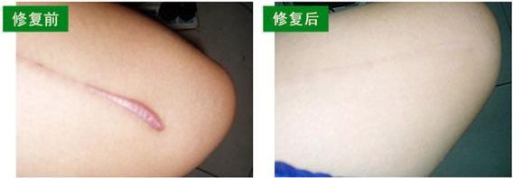 新鄉(xiāng)市眼袋手術(shù)哪家好？選擇新鄉(xiāng)市口碑最佳的眼袋手術(shù)醫(yī)院