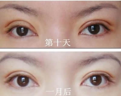 2023洛陽額頭打除皺針在榜單前十位醫(yī)生(劉戰(zhàn)輝、黃浩浩、周先華手法嫻熟自然)