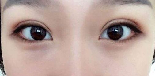 永州地區(qū)哪家正規(guī)整形醫(yī)院好？