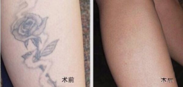 不二選擇！上海鼻修復(fù)專家徐永豐、劉仁輝搶占熱門名單成功！個(gè)人實(shí)力攀升不可阻擋！