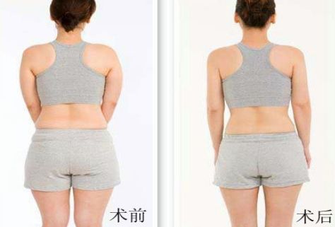 杭州哪家祛痘醫(yī)院好？綜合評(píng)測(cè)幫你選擇！