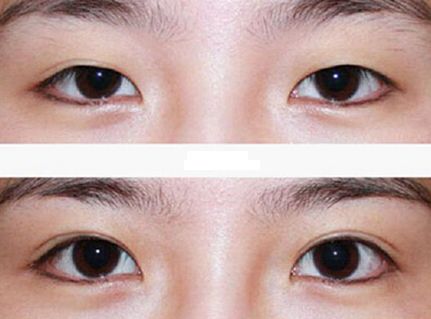 廣州整容鼻子技術排名前列的醫(yī)院有哪些？