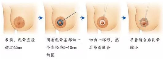在哈爾濱做除皺哪家醫(yī)院好？選擇專業(yè)除皺醫(yī)生，享受高質(zhì)量護理服務