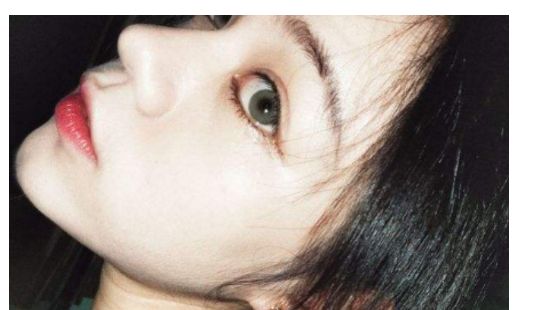 找一家靠譜的汕頭去除疤痕醫(yī)院？看這里！