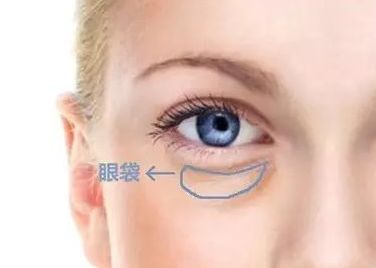 蘇州哪家醫(yī)院治療黃褐斑效果好？