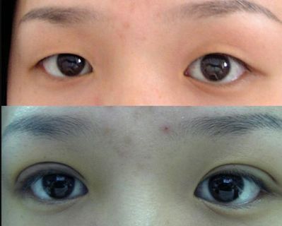 唐山哪家鼻子整形醫(yī)院好？權(quán)威專家為您解答