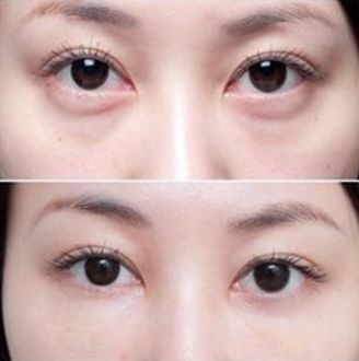 杭州厚唇變薄醫(yī)院哪家好？